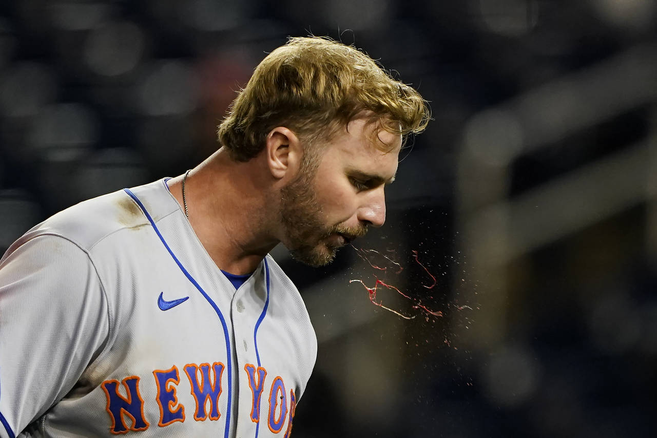 New York Mets' Pete Alonso, center, spits blood after being hit by a pitch from Washington National...