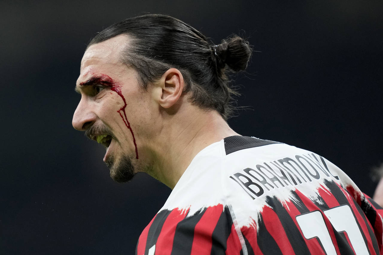 AC Milan's Zlatan Ibrahimovic reacts after an injury from a header during the Serie A soccer match ...