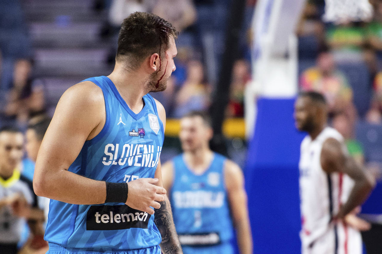 Slovenia's Luka Doncic is bleeding from the head during the Eurobasket group B basketball match bet...